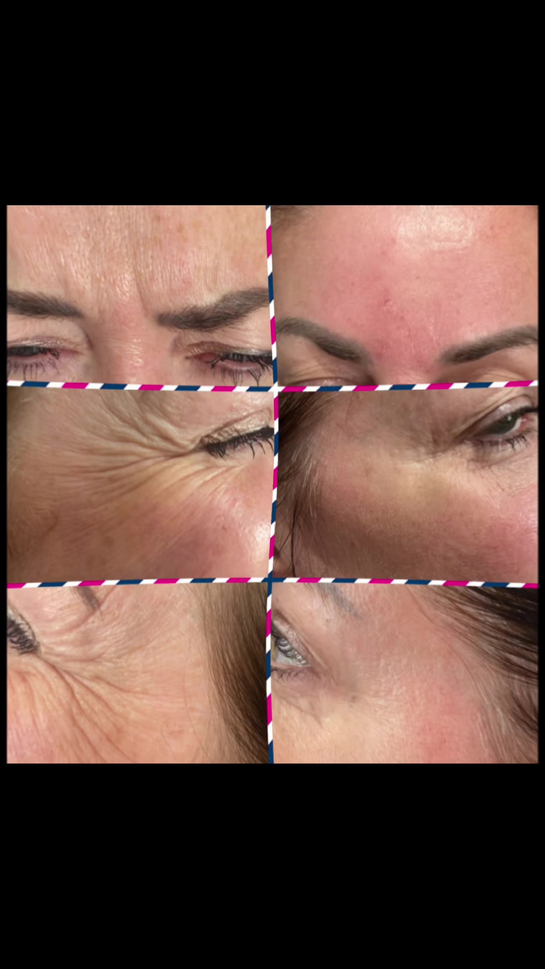 @Diamond Aesthetics Barnsley