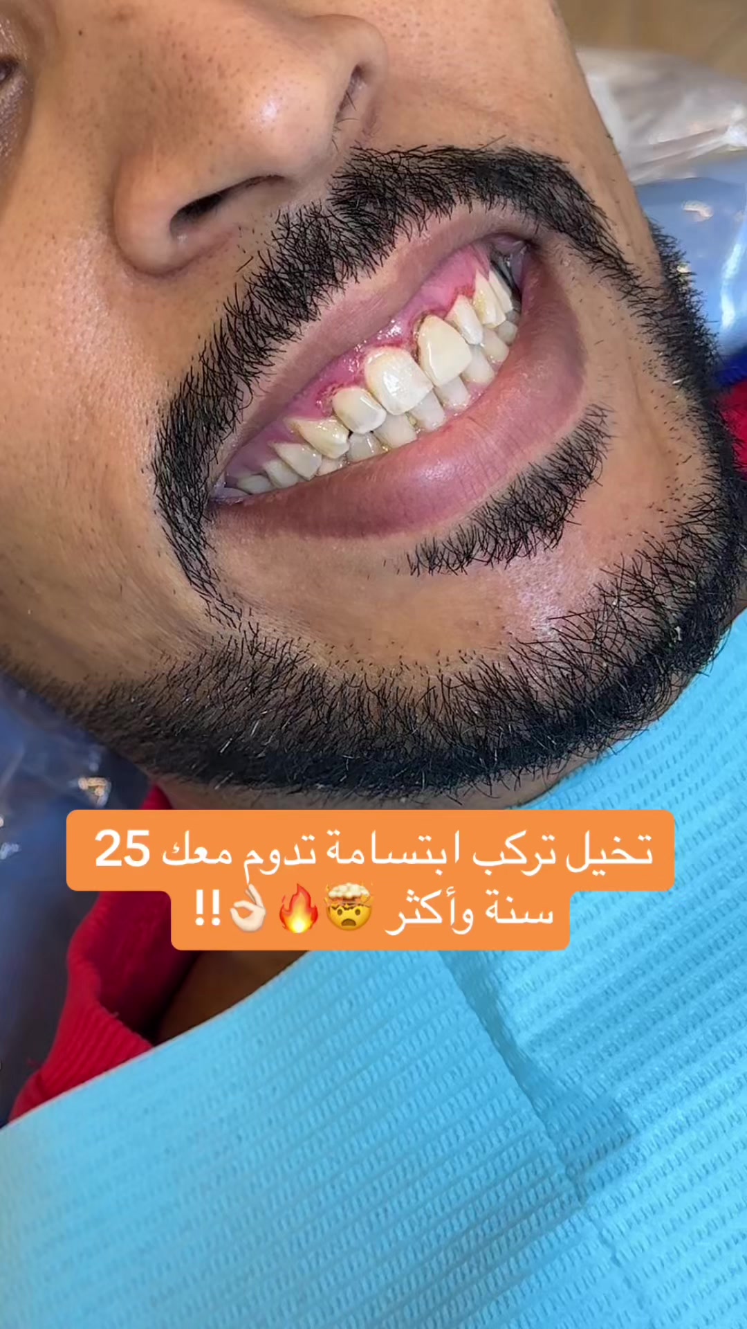 @Dr.ranaalsilani