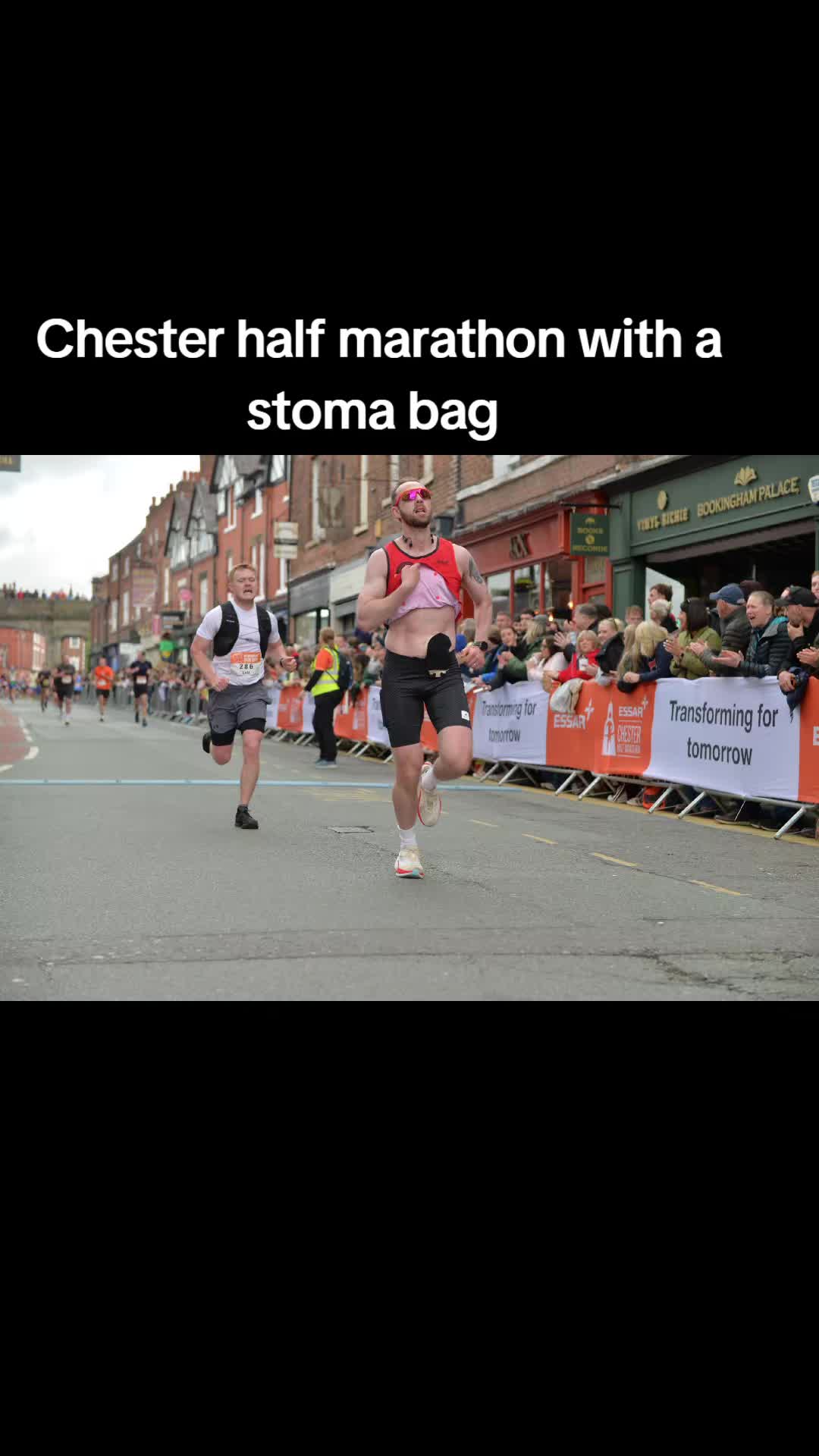 @Running Stoma