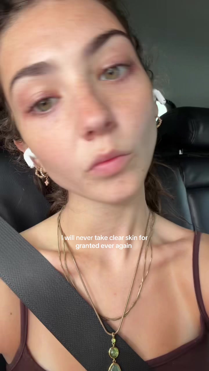 @eliza