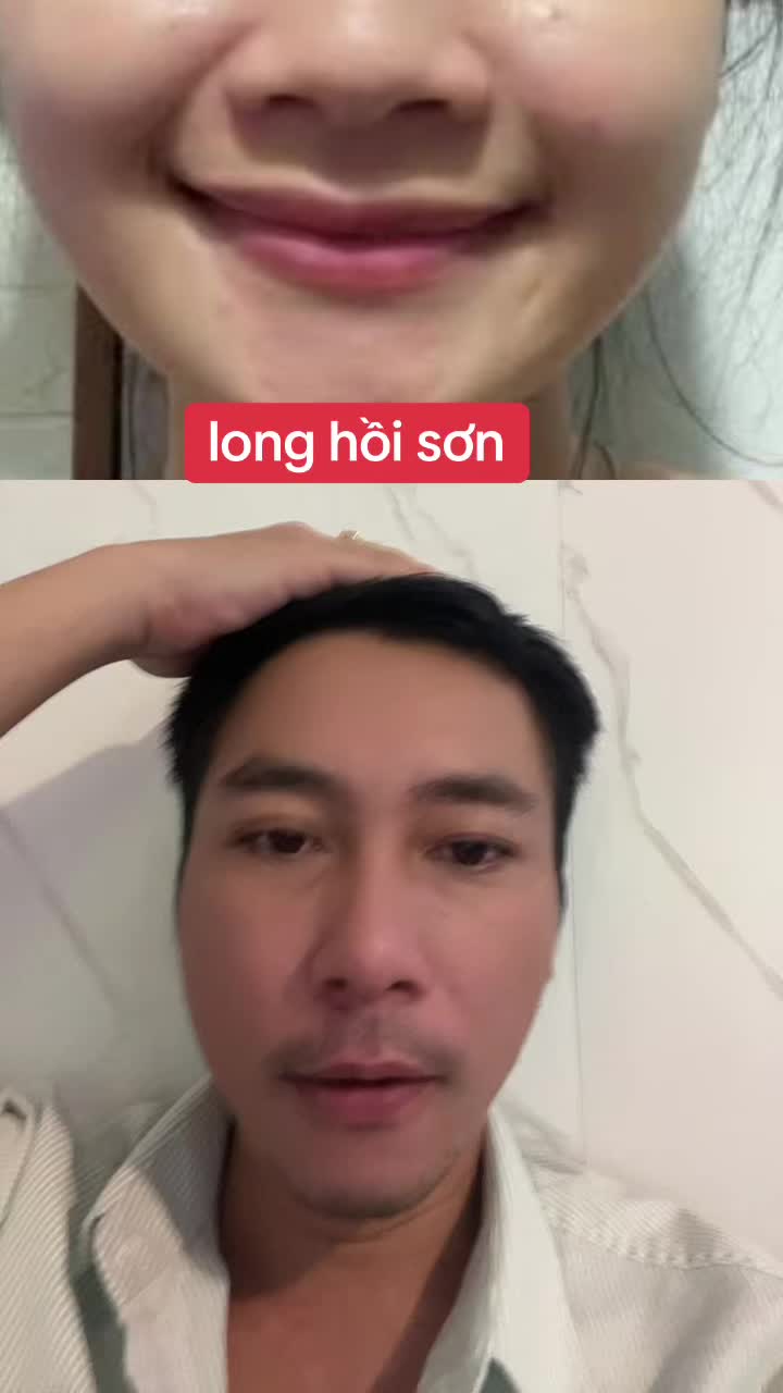 @Tuệ Nhãn ✅