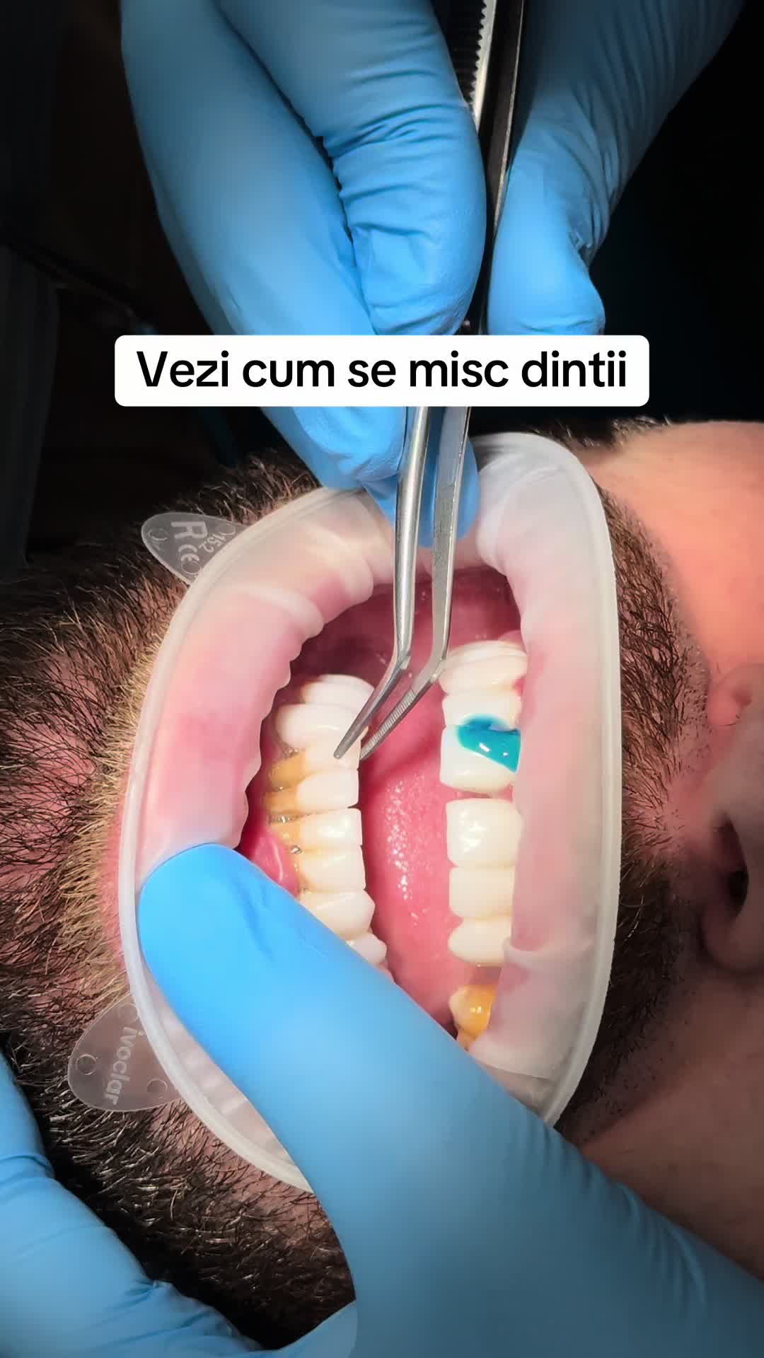 @DR.OMAR