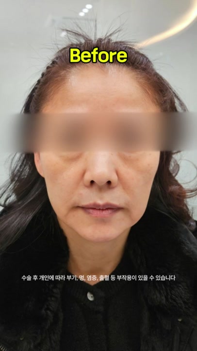 @리프성형외과 김기엽 대표원장