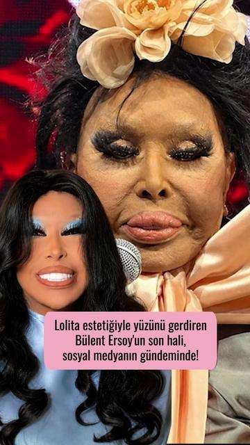 @Mynet Kadin