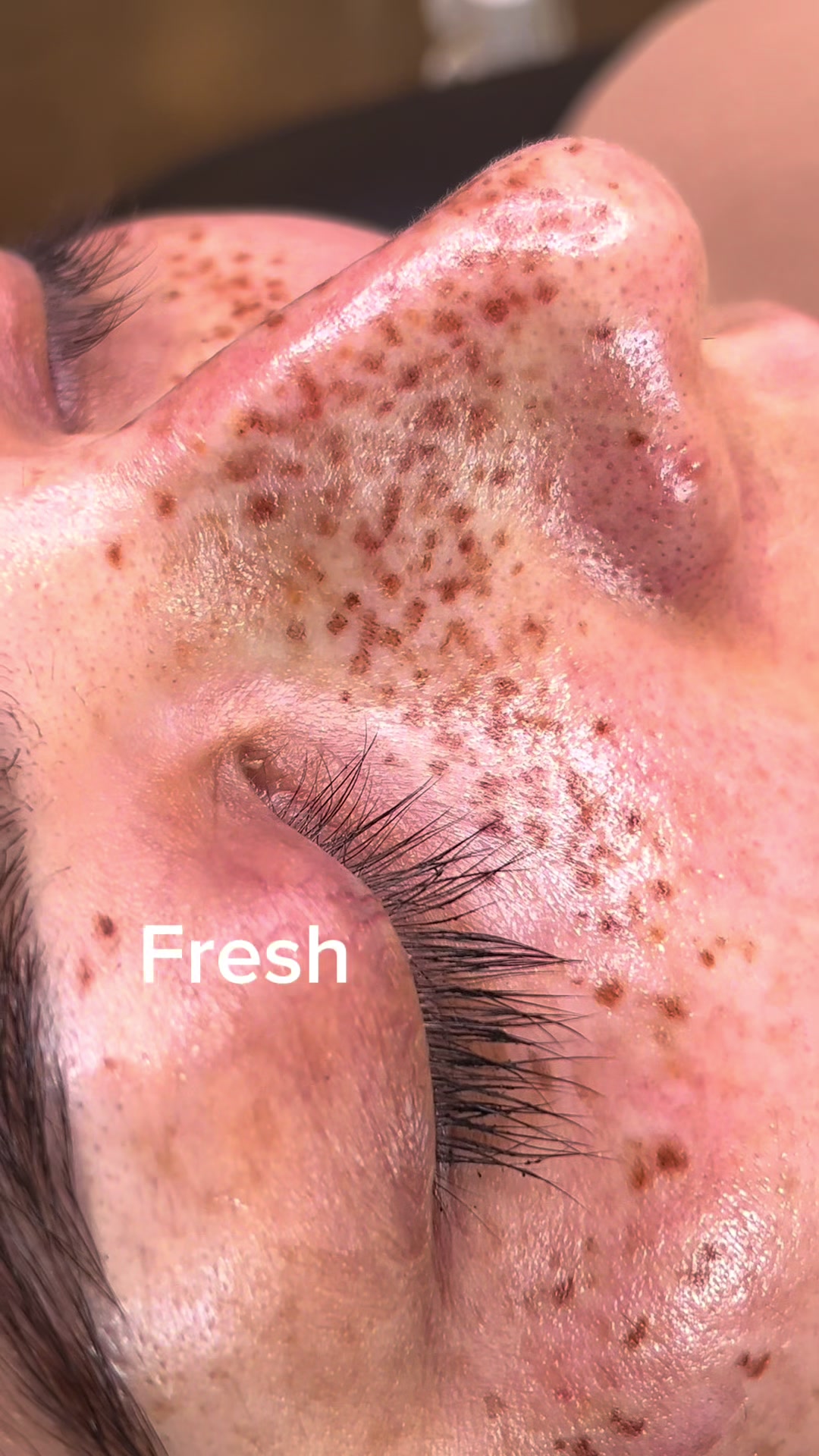 @Consuelo | Faux Freckles