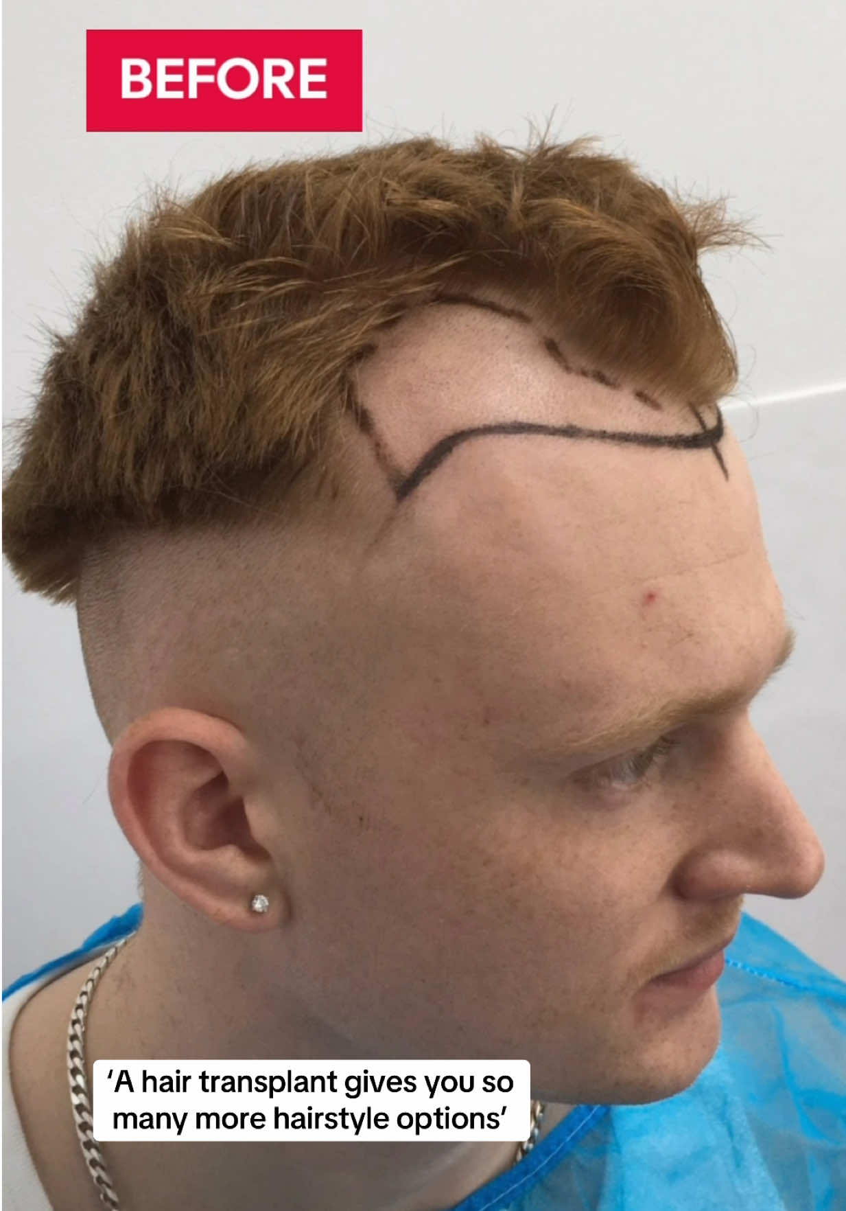 @British Hair Clinic
