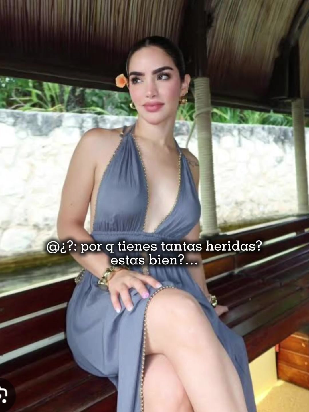 @zoeeee
