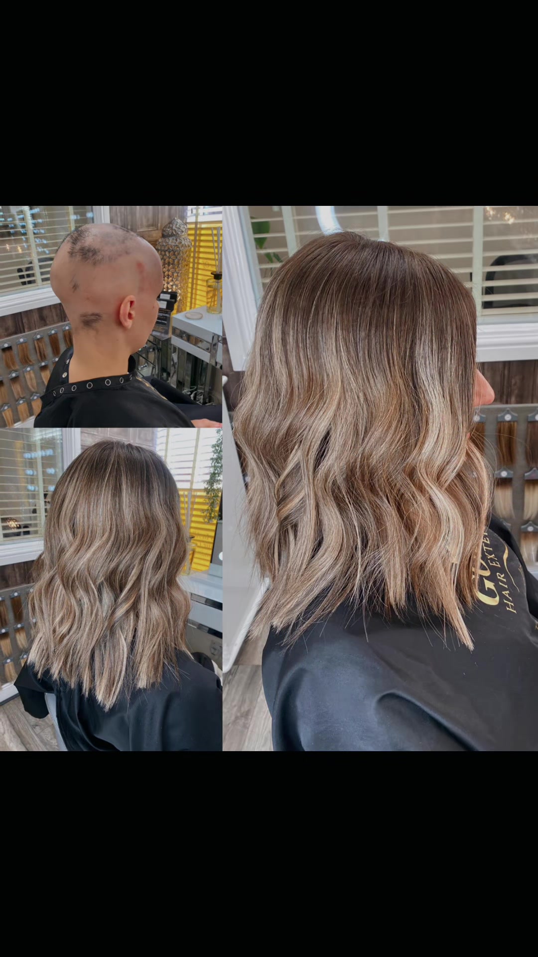 @Godiva Hair Loss Specialists