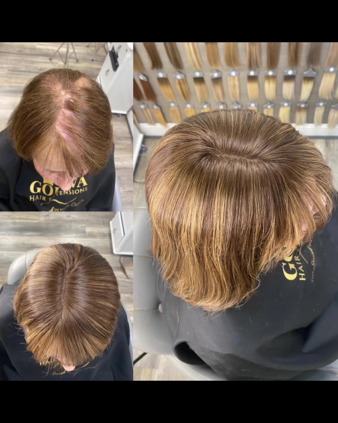 @Godiva Hair Loss Specialists