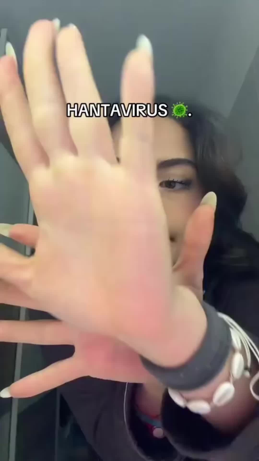@💗