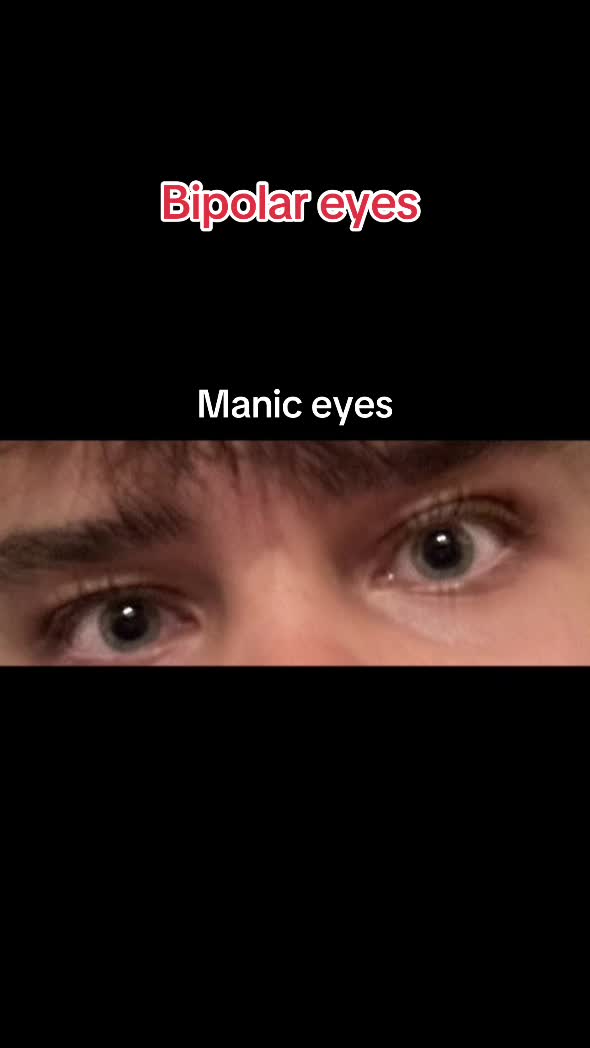 @bipolar.peter
