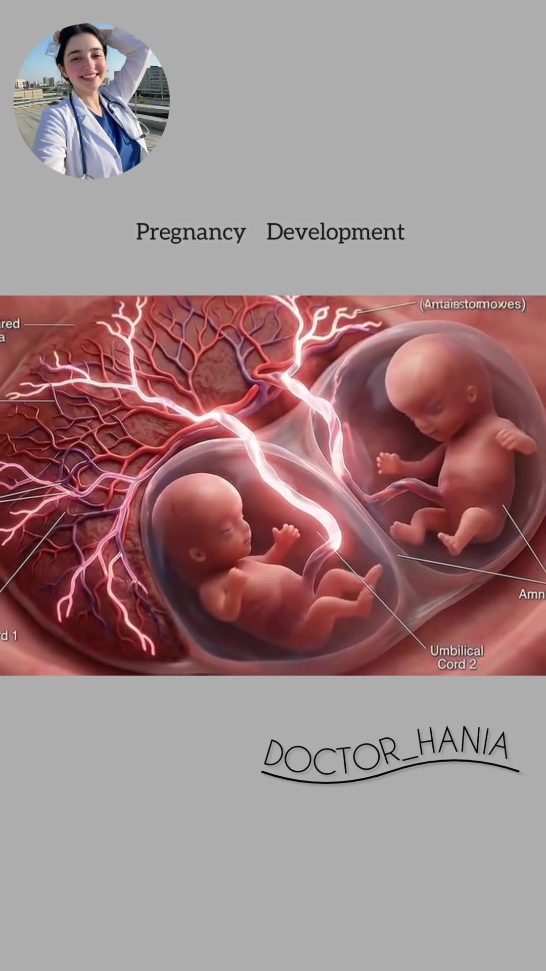 @Doctor Hania