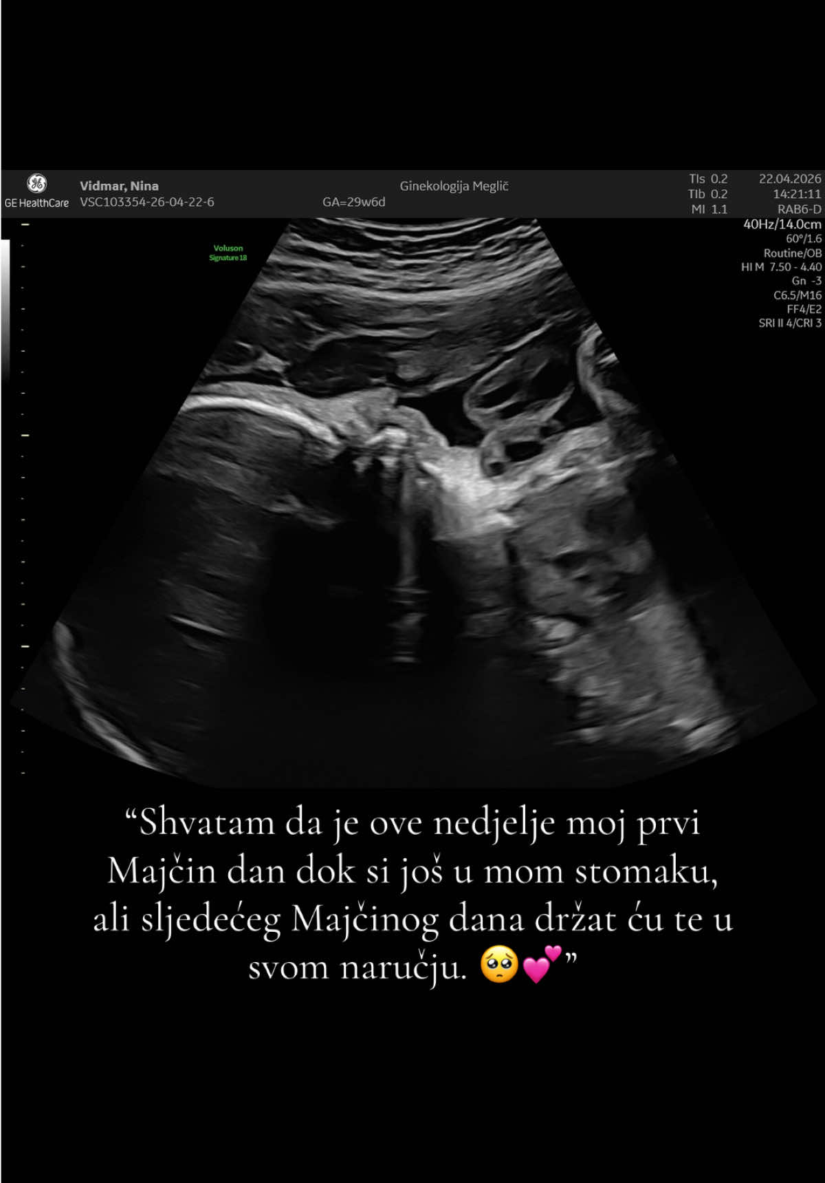 @Nina Ninči Kardaševič