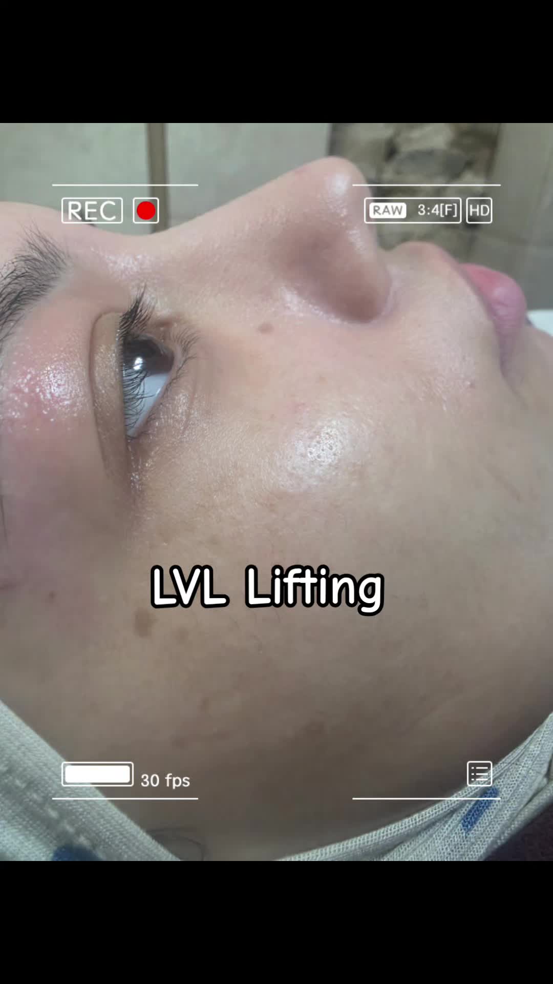 @EL Beauty & Aesthetic
