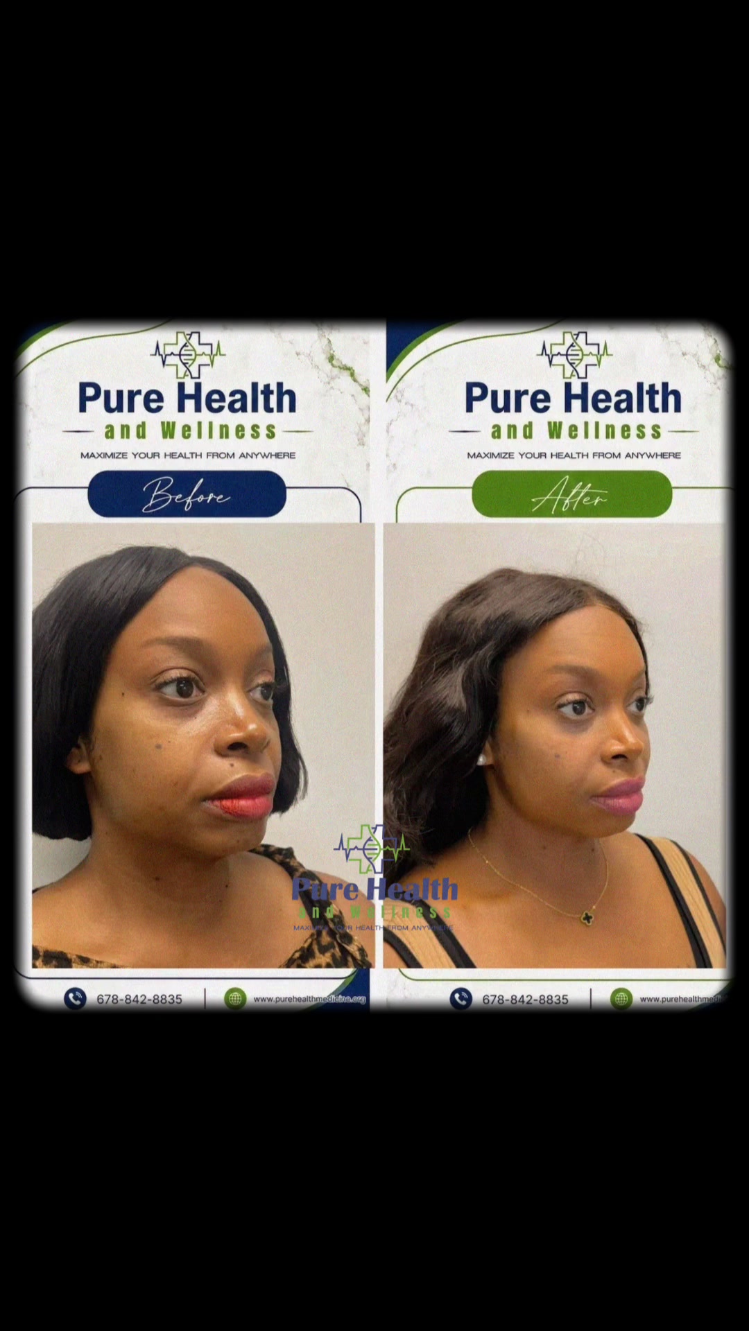 @PureHealthand_Wellness