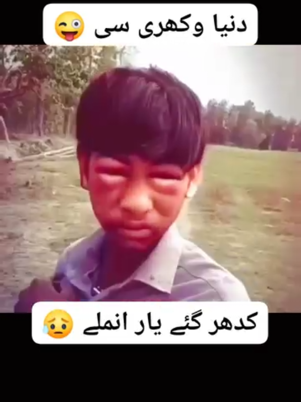 @Bahadur Ali
