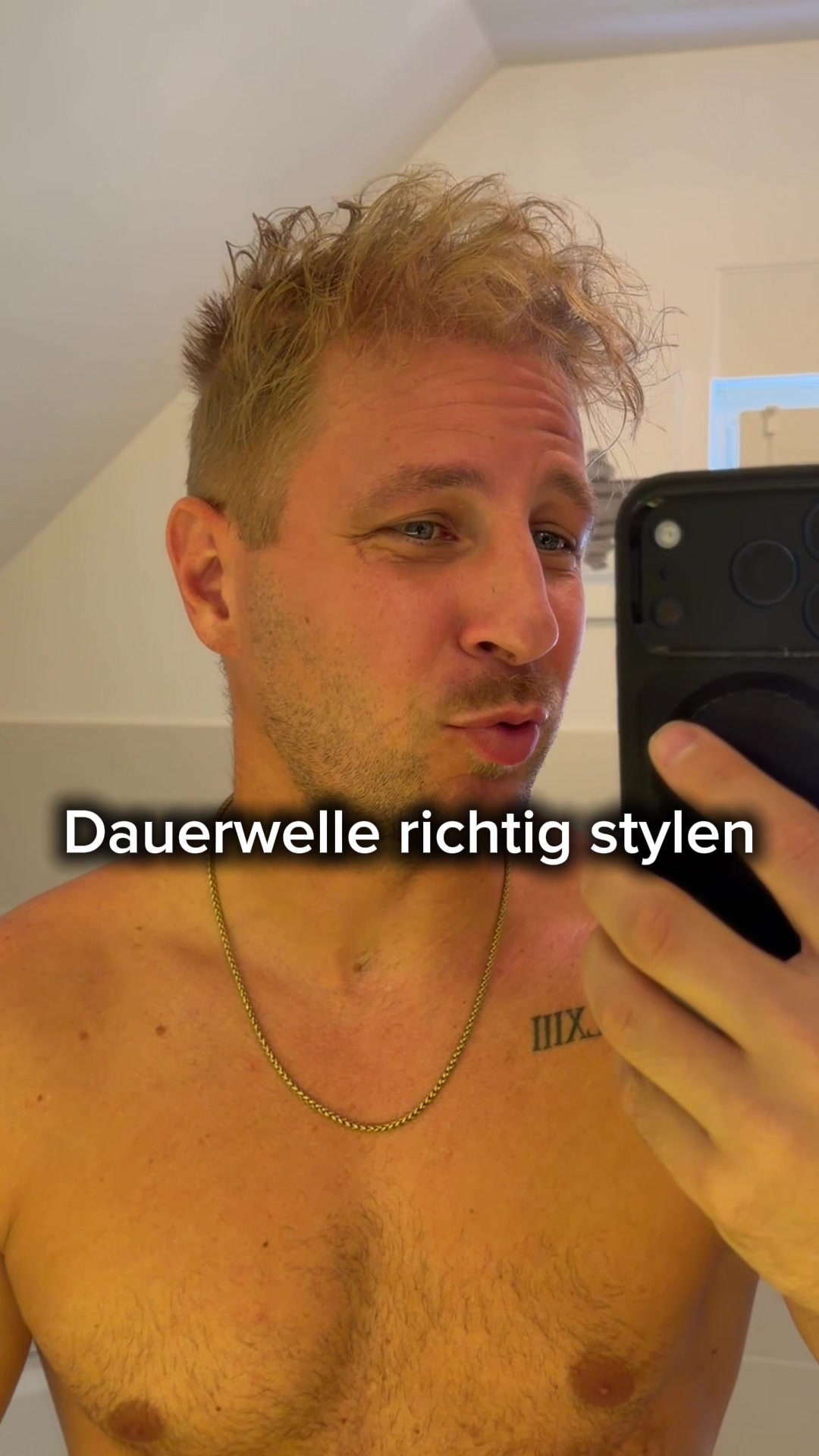 @Mr. Hairtransplant