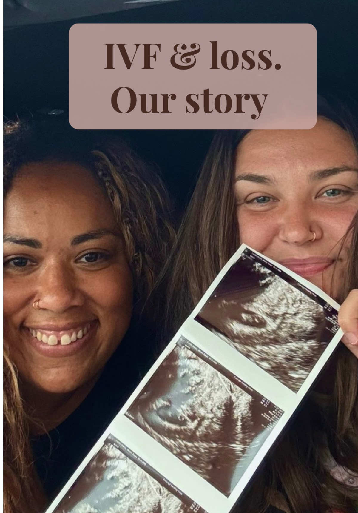 @Alexis & Charlotte- IVF & Loss