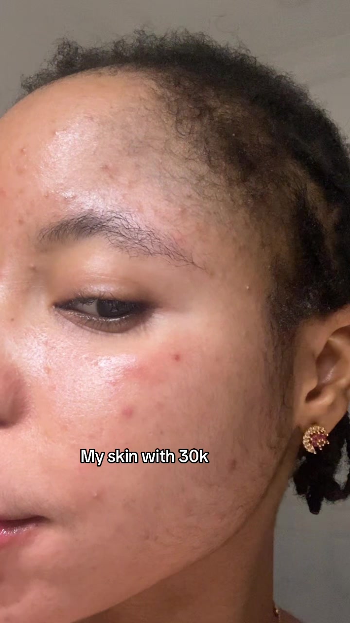 @Your skin solution🇳🇬🇬🇭🇬🇧