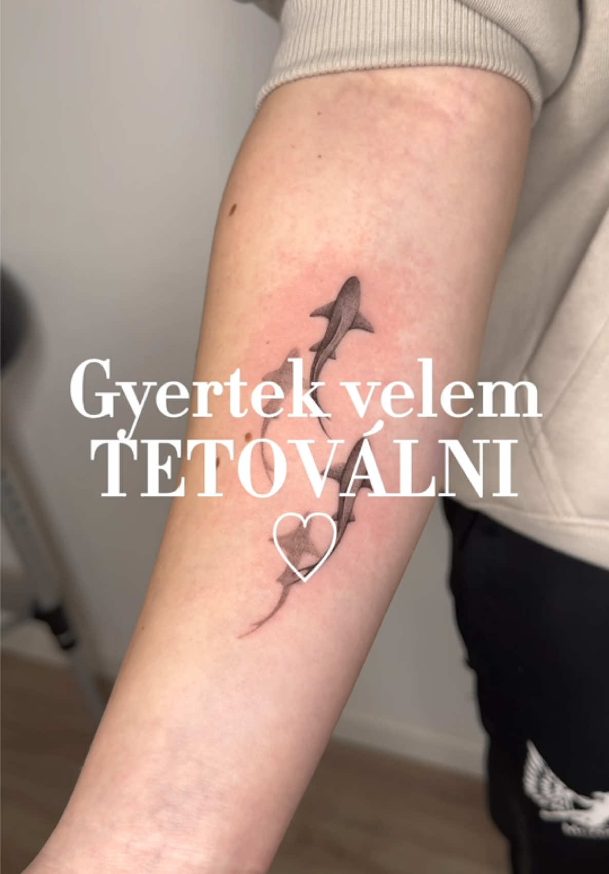@N&eacute;methy N&oacute;ra