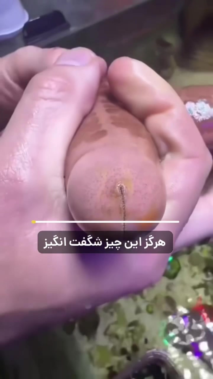 @تیم اعتماد | متخصص افزایش قد