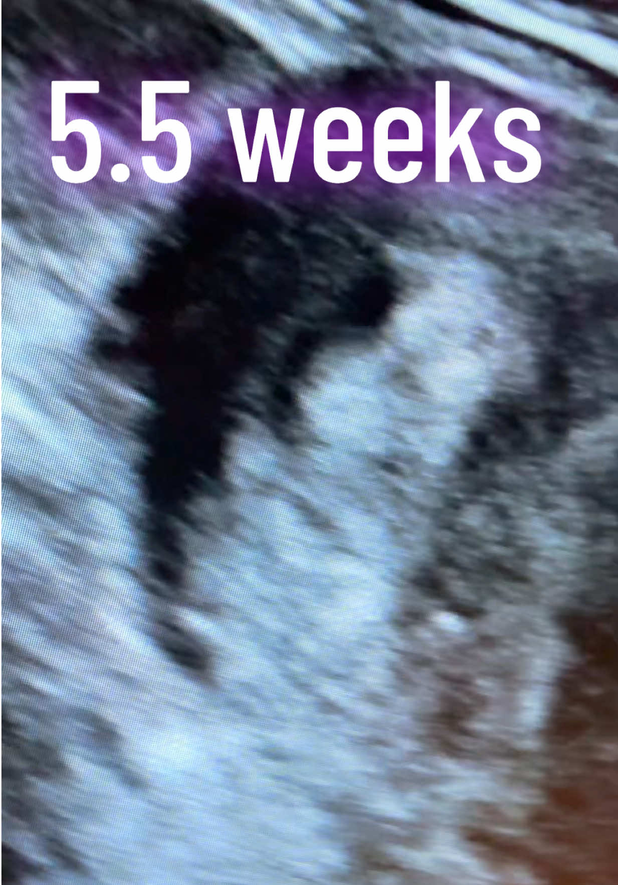 @PregnantSee Inc.