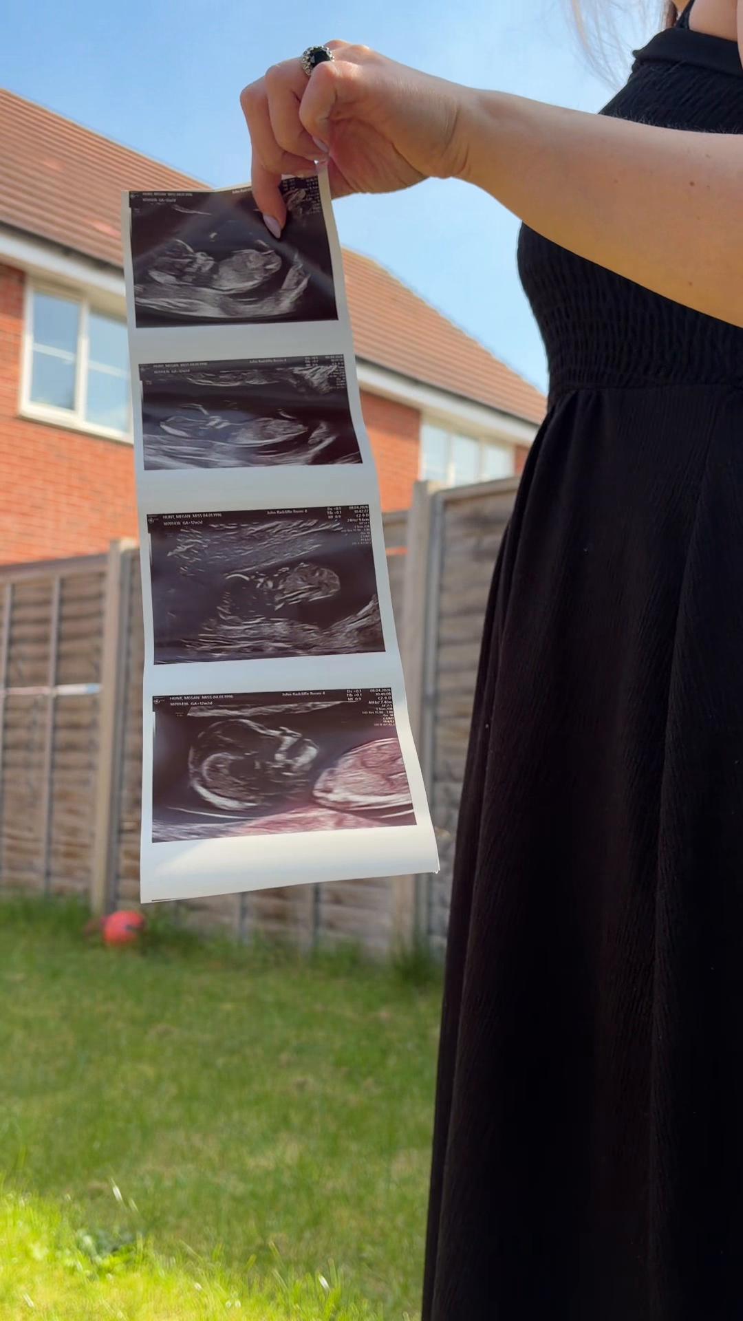 @Meg 🌈 pregnancy after loss
