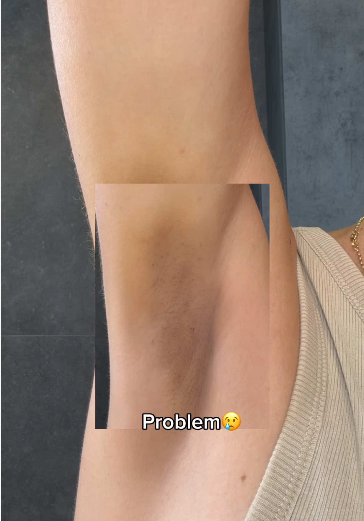 @Loresa