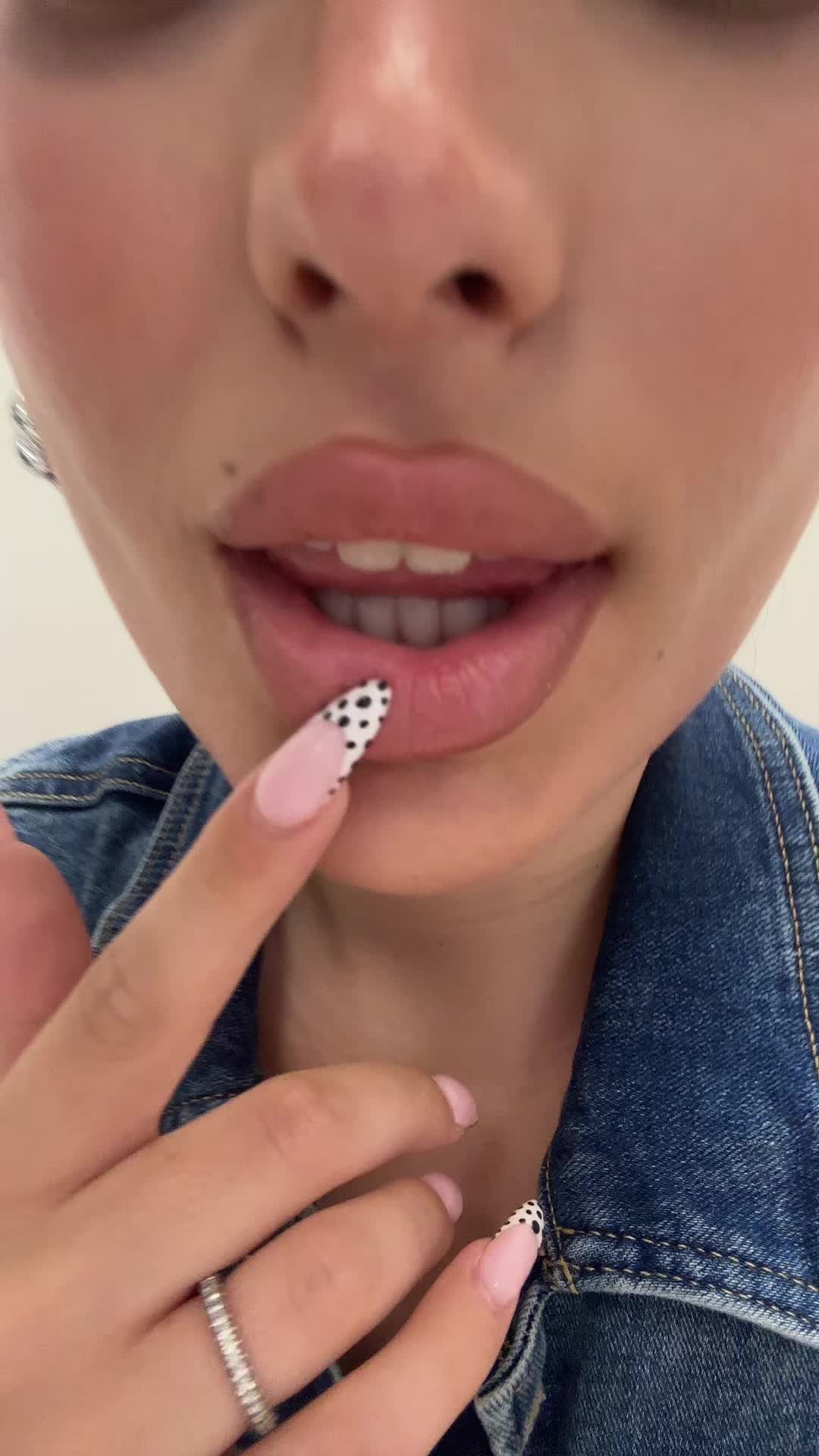 @Anita