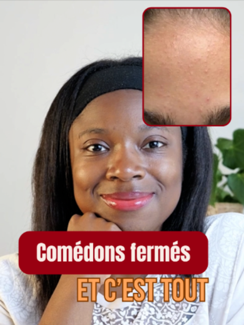 @Hyperpigmentation & Glow ✨