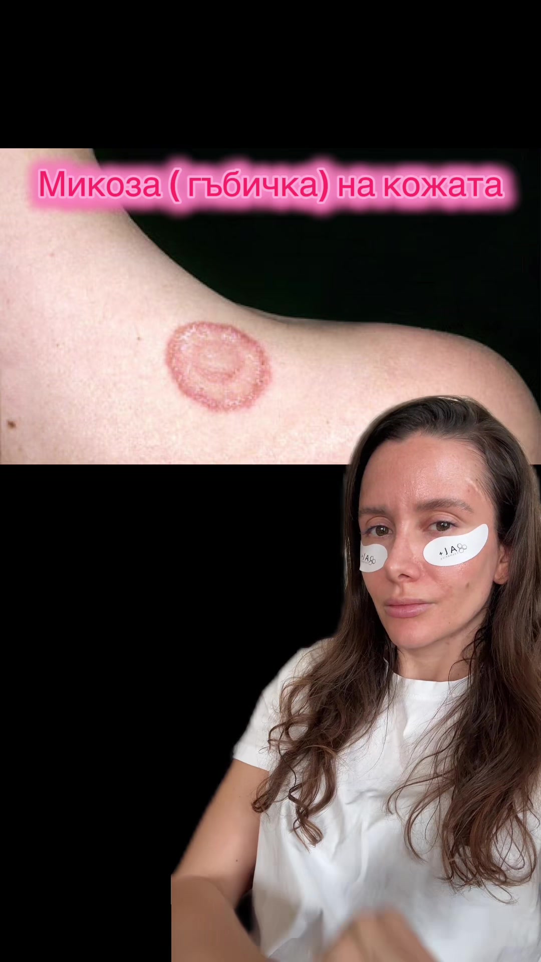 @💉👩🏻&zwj;⚕️ СкинТок Дерматолог