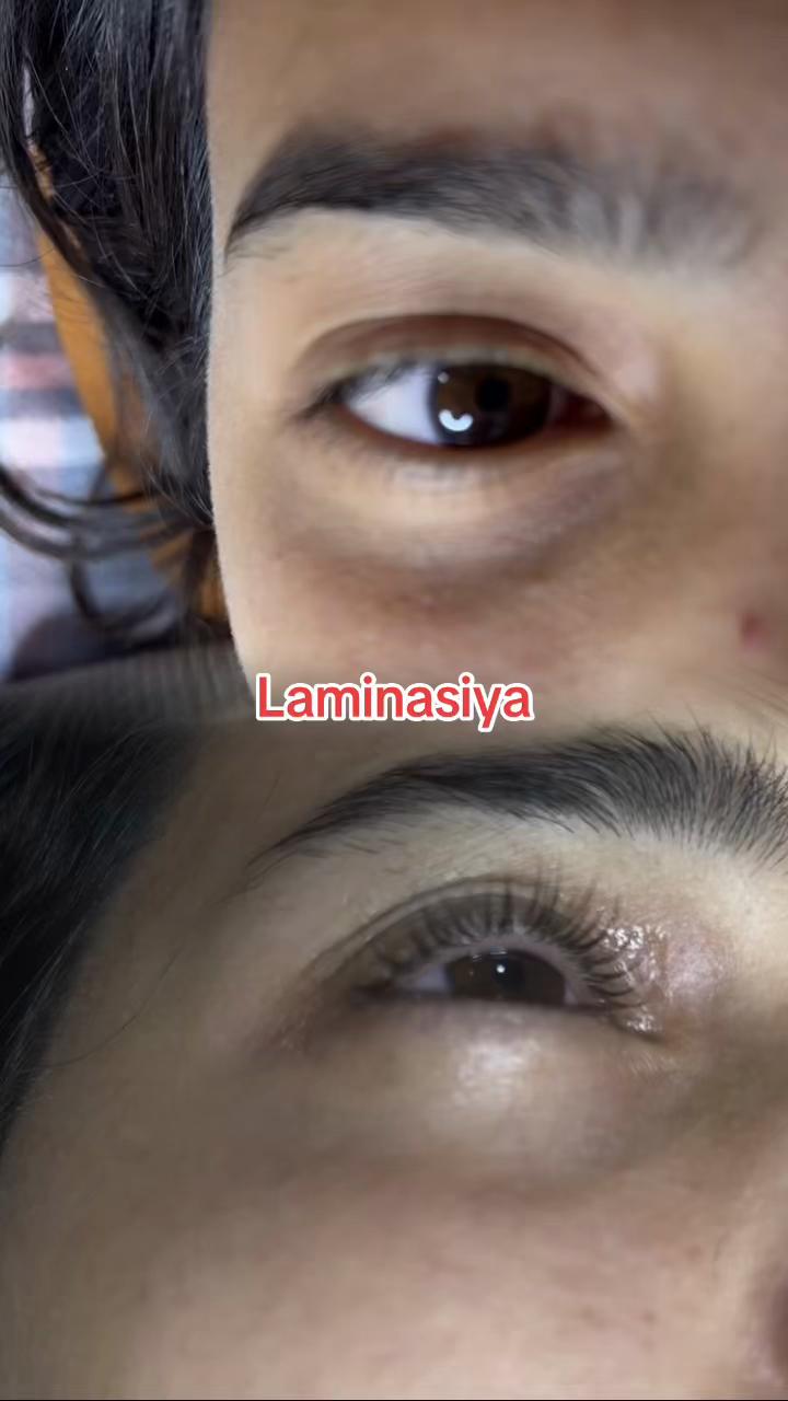 @Bantik_Lazer_epilyasiya_