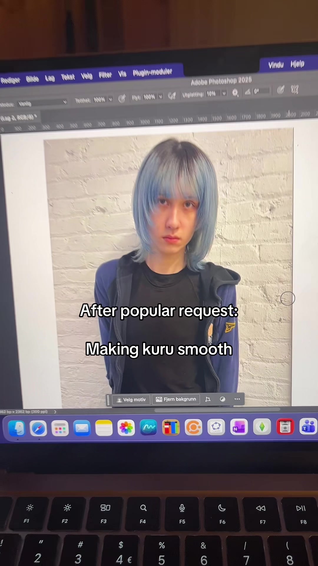 @turnip