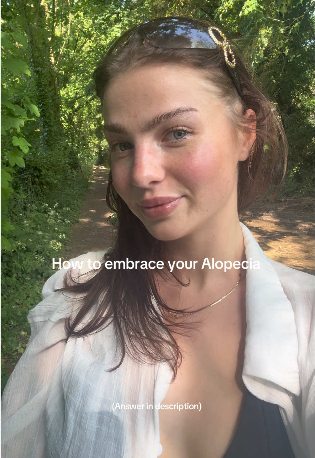 @Brooke💗Hair loss Journey