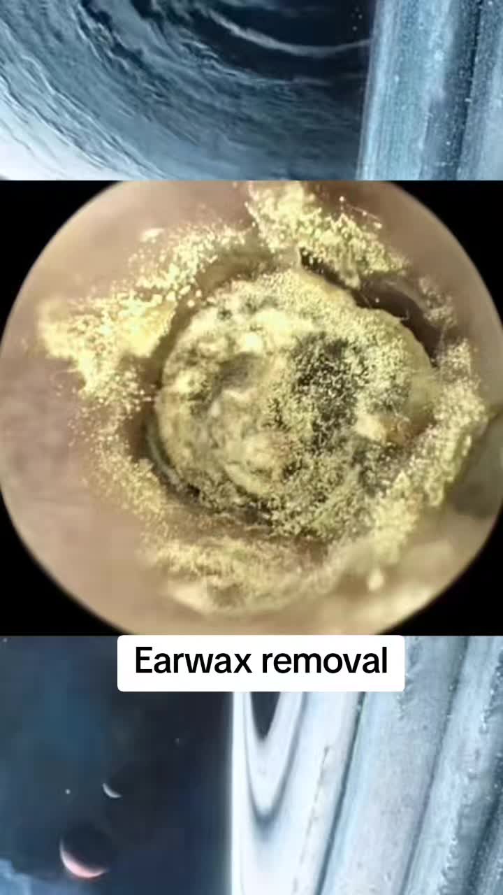 @Earwax.pro
