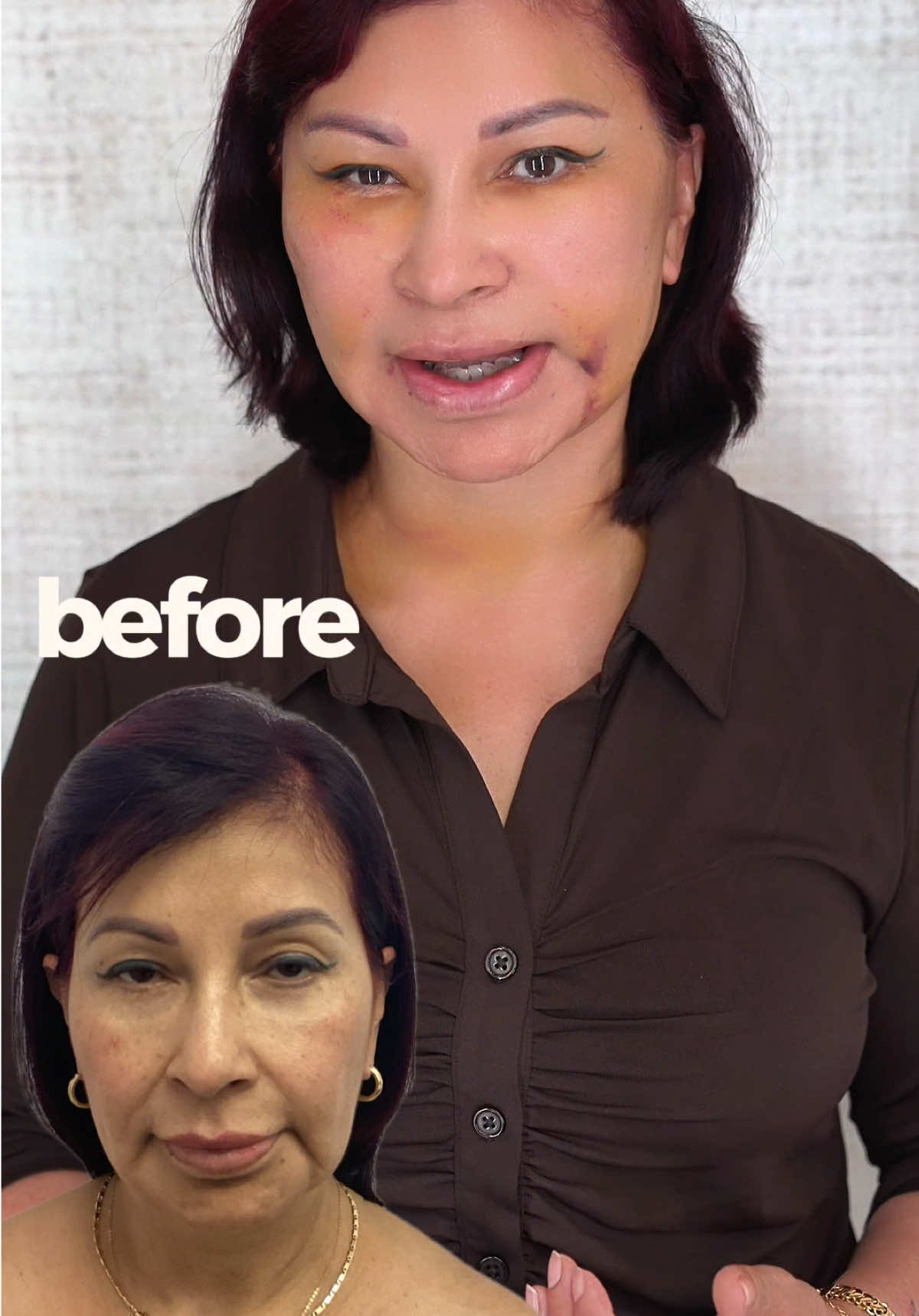 @Dolls Plastic Surgery