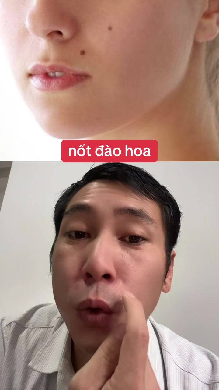 @Tuệ Nhãn ✅