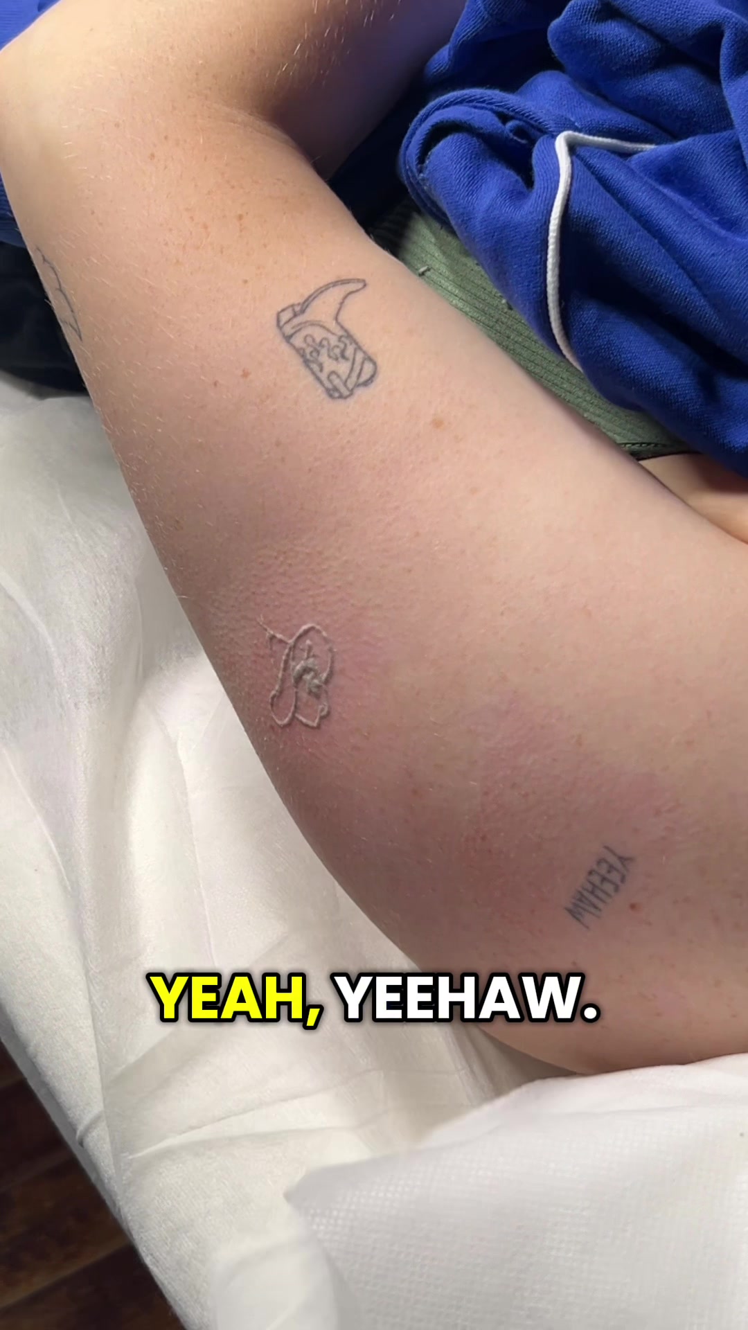 @Swift_tattoo_removal