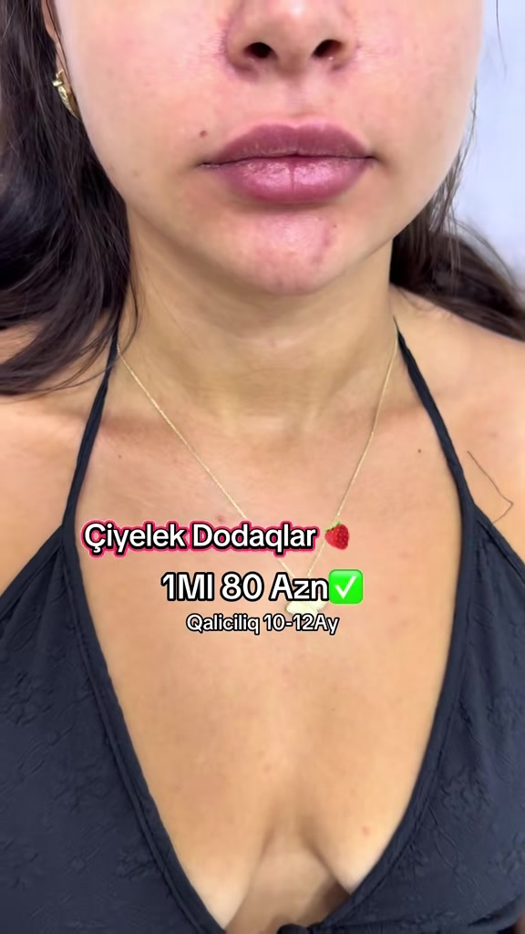 @Kosmetoloq_Gülü_Rajab