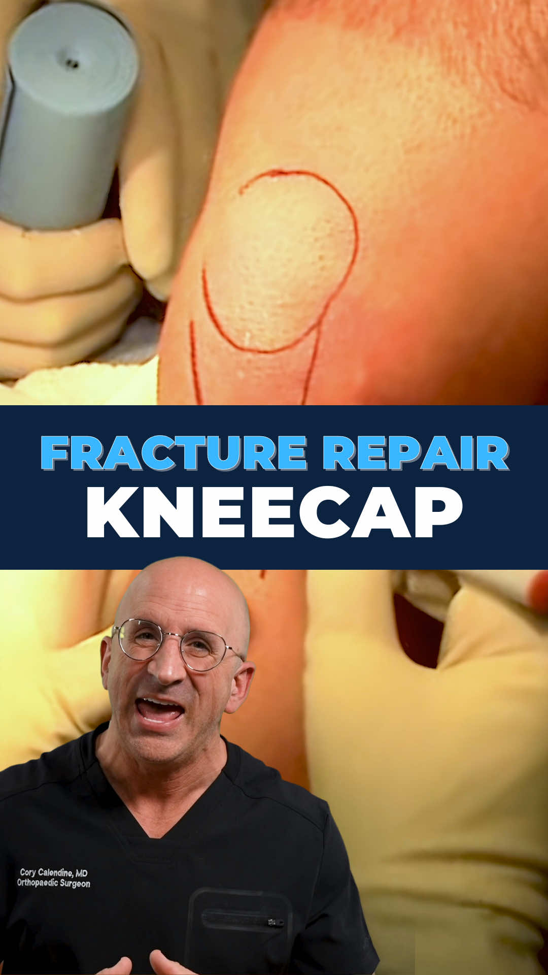 @Bone Doctor - Joint Pain MD