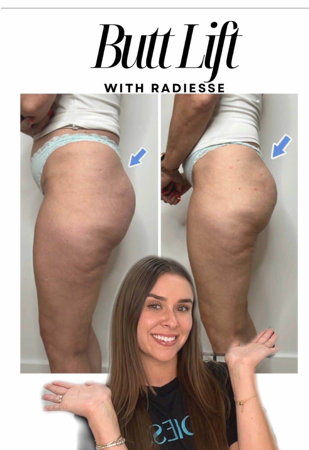 @injectoraleenp