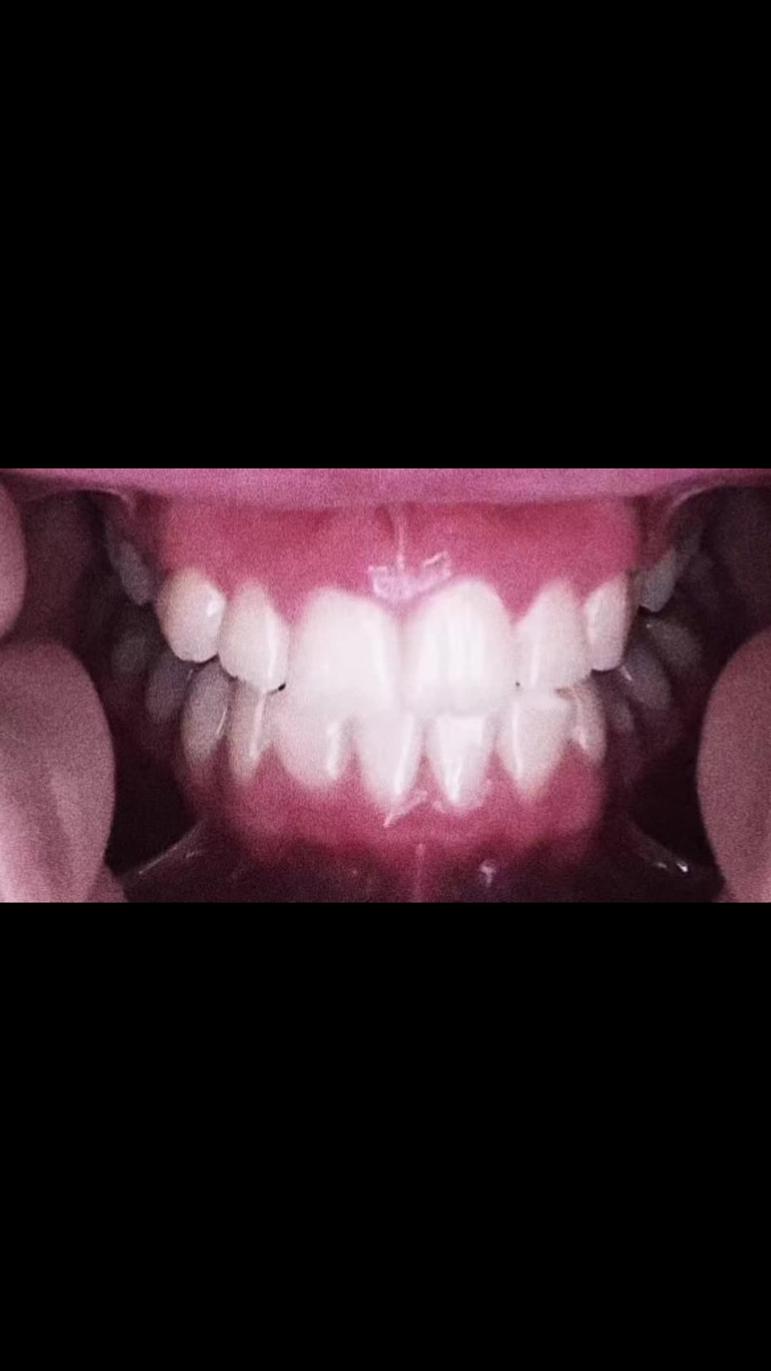 @teeetharecool