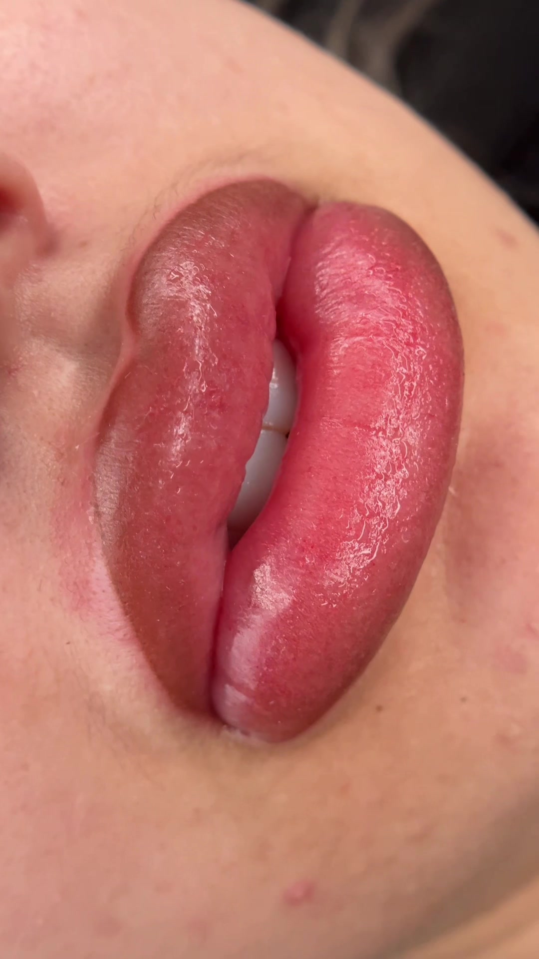 @Permanent Makeup & Removal