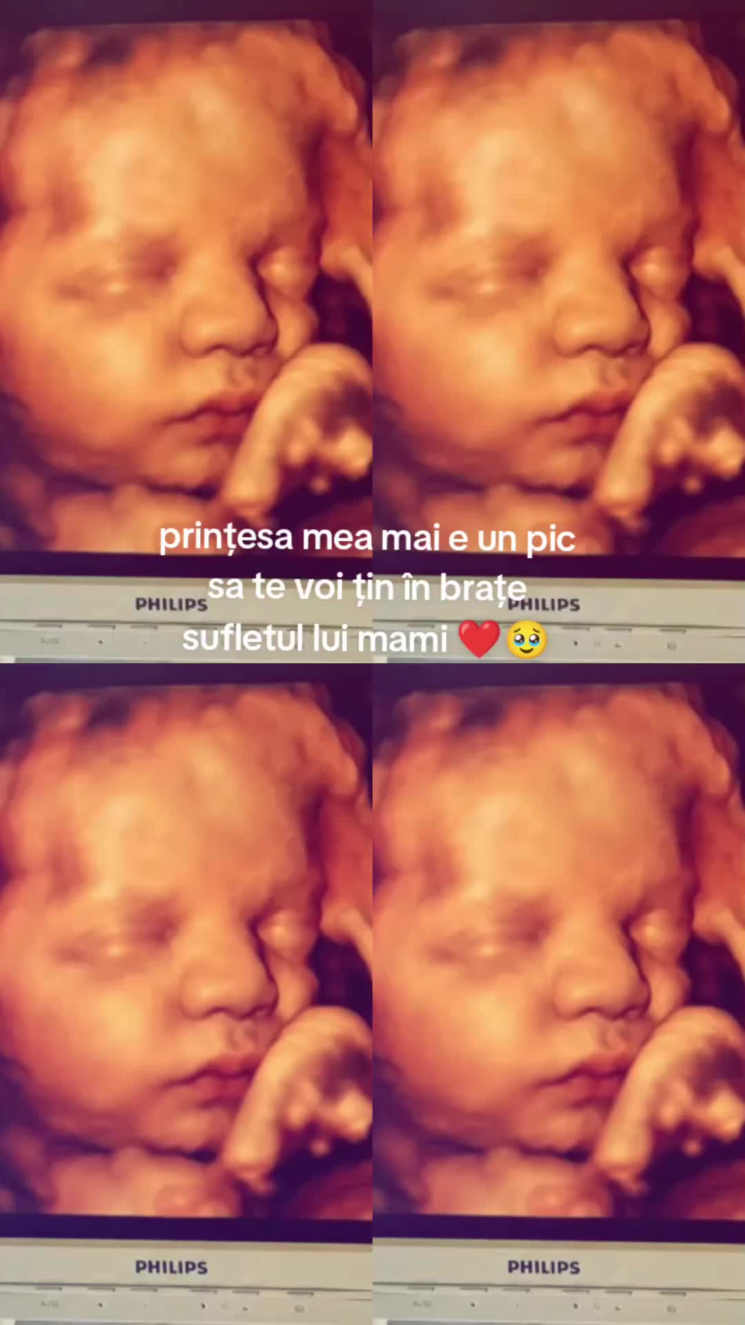 @Nikolas ana