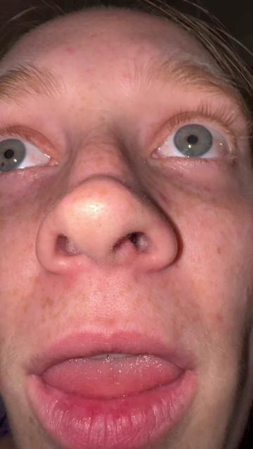 @AlsoImBroken