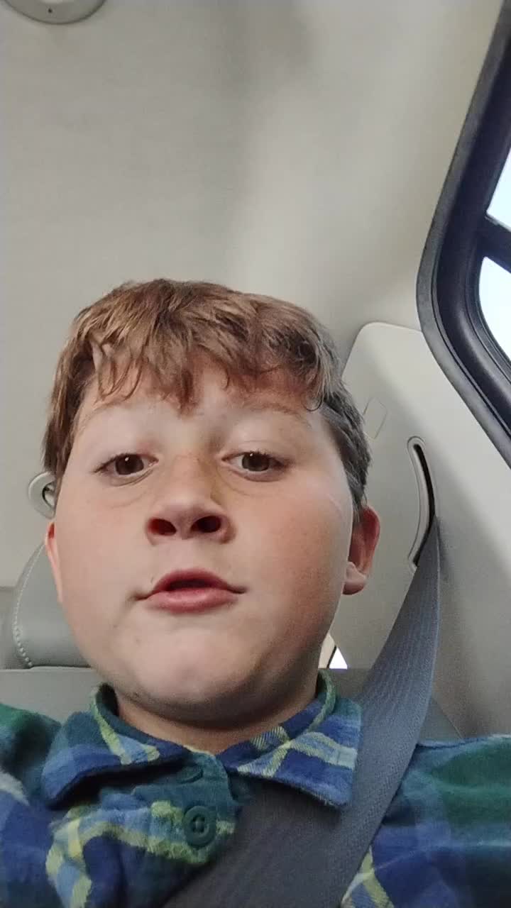 @VISON EDITS