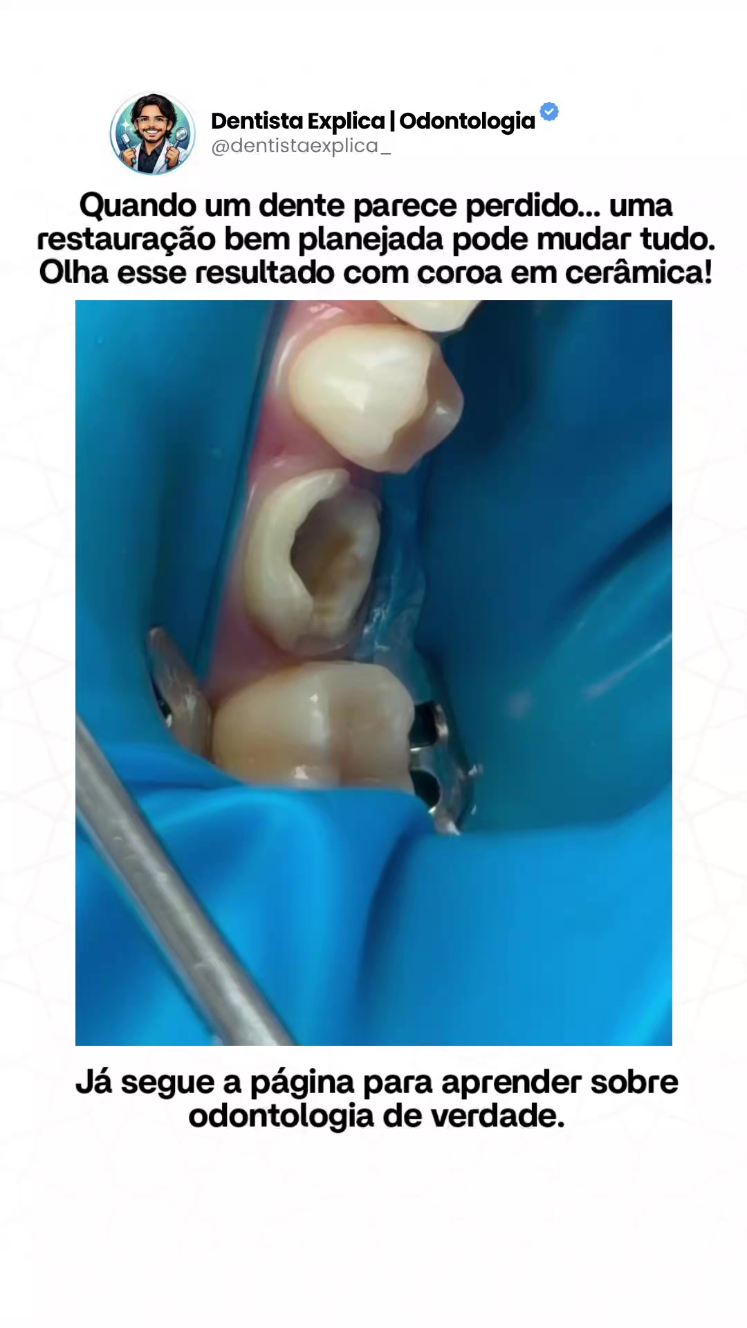 @Dentista Explica | Odontologia