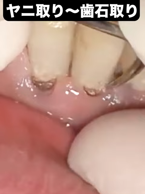 @2lz7snkiaz5