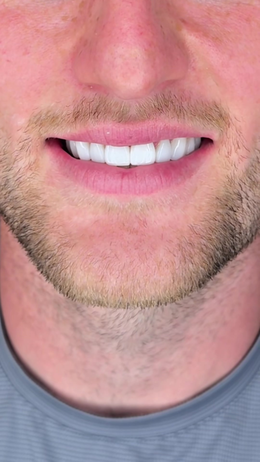 @Dentalexcellenceuk