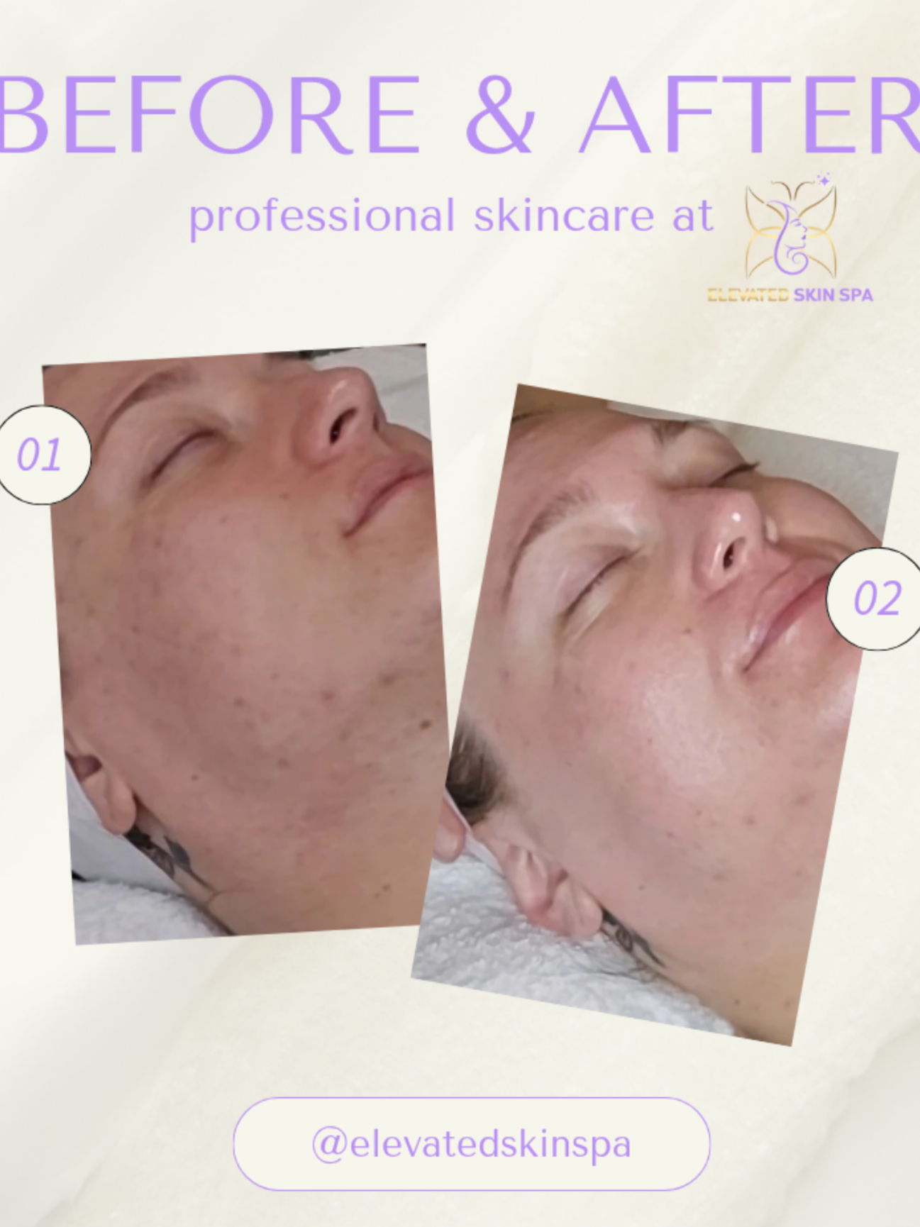 @Elevated Skin Spa by Monika